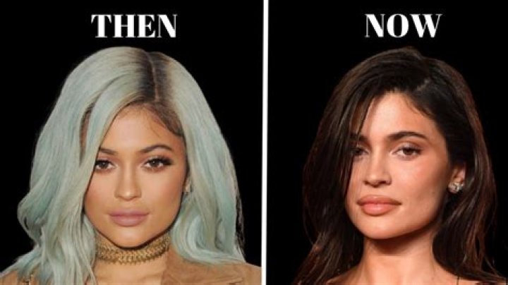 Kylie Jenner Before Pics: Unveiling Transformation and Evolution