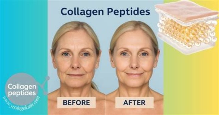Transformative Effects of Collagen Peptides: Before and After