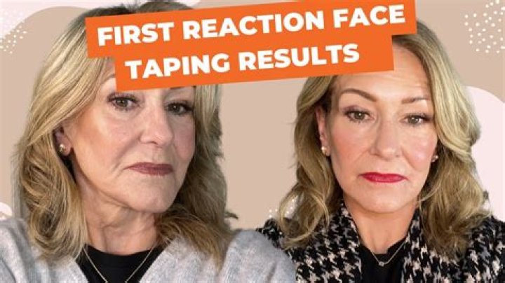 Unveiling the Secrets of Face Taping Wrinkles: A Revolutionary Approach to Youthful Skin